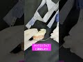 【矯正器具解説】ヘッドギア│歯列矯正│#shorts
