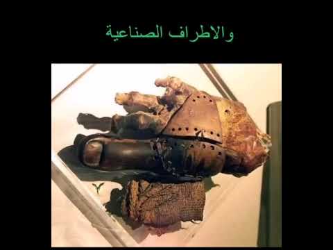 كيف عامل المصريين القدماء ذوي الاحتياجات الخاصة