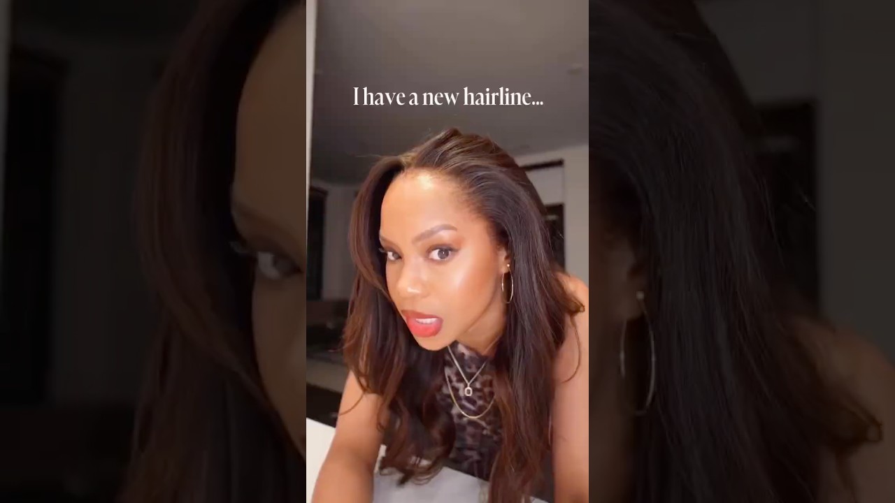 This Hairline changed Everything 🔥 