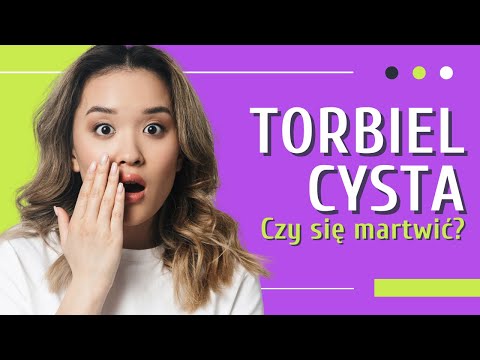 Torbiel 👉 Cysta  👉Czym jest? 👉 Czy jest groźna?