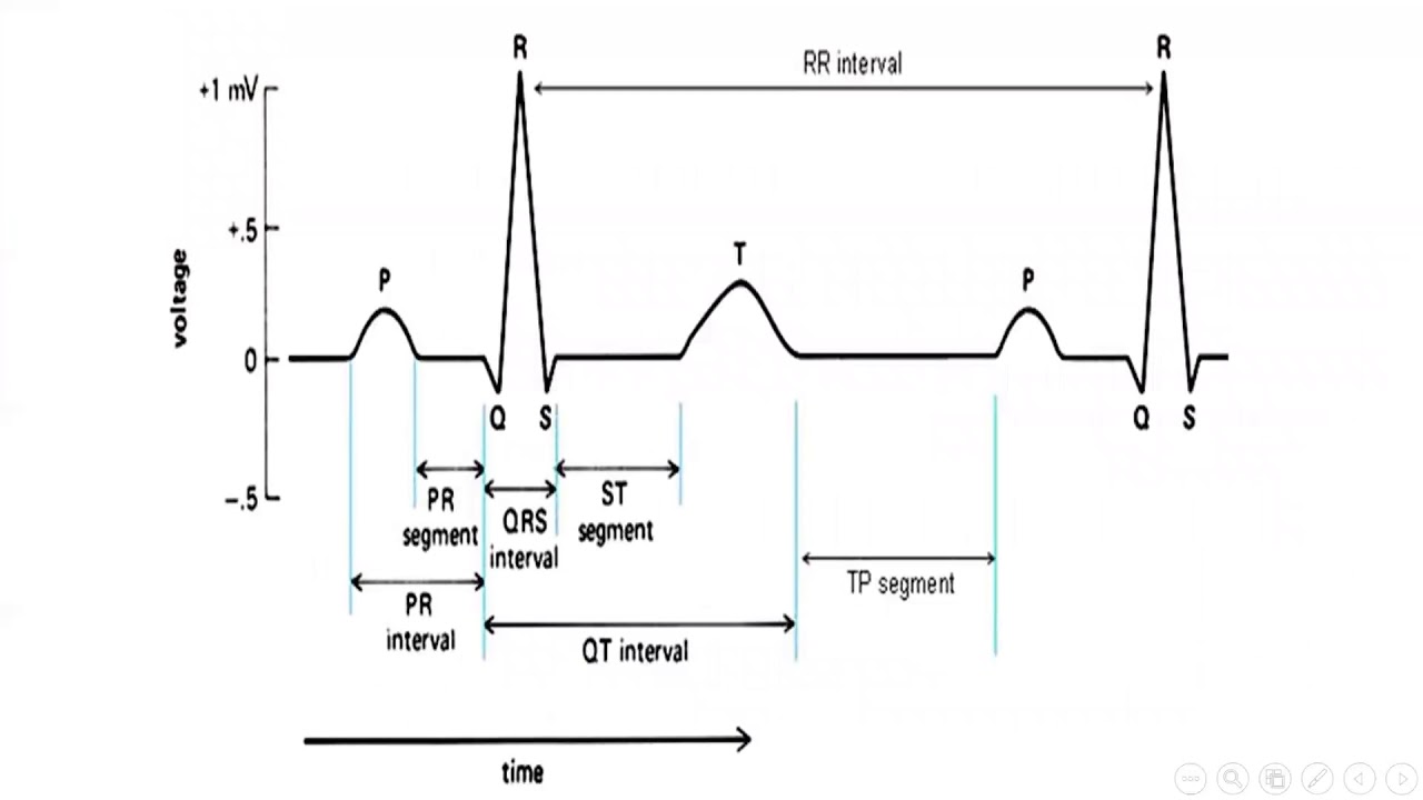 Экг 22. Патология QRS на ЭКГ. Комплекс QRS на ЭКГ. Электрокардиограмма PQ QRS qt. Комплекс QRS на ЭКГ норма.