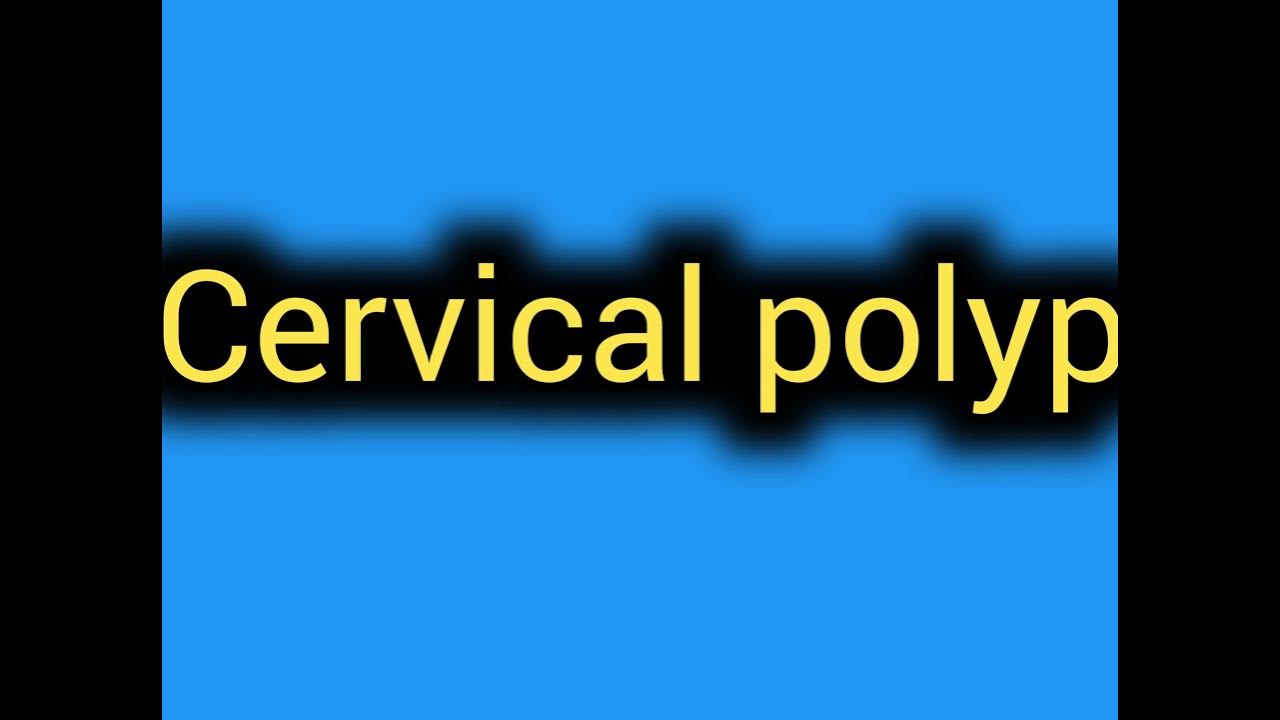 Cervical Polyp Per Speculum Examination Youtube 