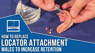 Download Lagu How To Replace Locator Attachment Males to Increase Retention By PREAT Corporation MP3 Download Lagu How To Replace Locator Attachment Males to Increase Retention By PREAT Corporation MP3