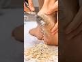 Cracked Heels Gone in 3 Days 😱 | Turmeric + Lemon +Coconut Oil Remedy | 100 % Result