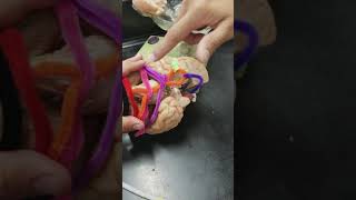 Ns102 10102017 brain arteries