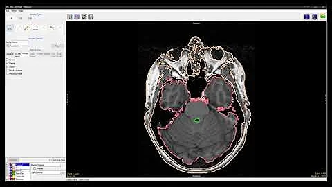 Analyze 14 .0 - Measure: Sample Borders