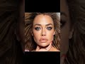 SURGERY &amp; LAWSUITS: Denise Richards Set for Surgery Amid Volatile Divorce