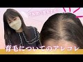 育毛についてのご質問まとめてみました＾＾