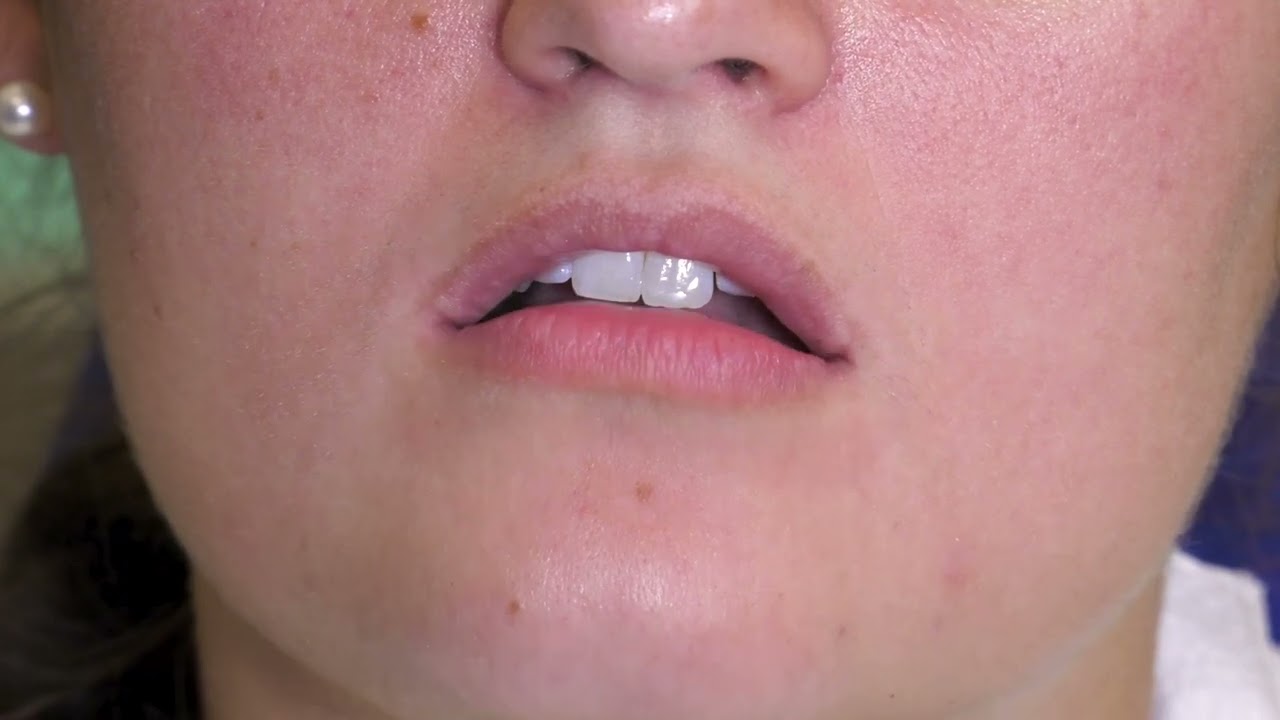 Dentists Save Lives: How to Perform an Oral Cancer Screening