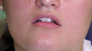 Dentists Save Lives: How to Perform an Oral Cancer Screening