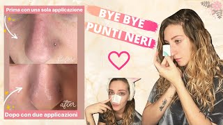 COME ELIMINARE I PUNTI NERI | Skincare Routine | FUNZIONA!!