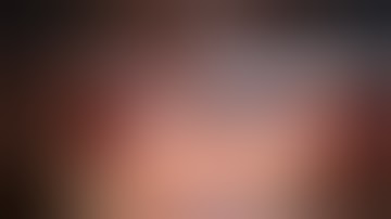 Robotic Sentinel lymph node for endometrial cancer