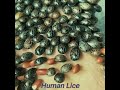 remove seeds the way men with dirty hands usually do 2026