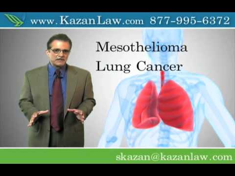 asbestos-exposure---malignant-lung-cancer---stockton-lawyer