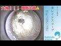 【耳そうじ】Vol.103 耳掃除動画の醍醐味詰め合わせ!?詰りand膜はりも綺麗にスッキリ❤️