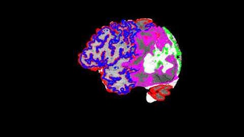Level Set Segmentation using Non-Negative Matrix Factorization with Application to Brain MRI