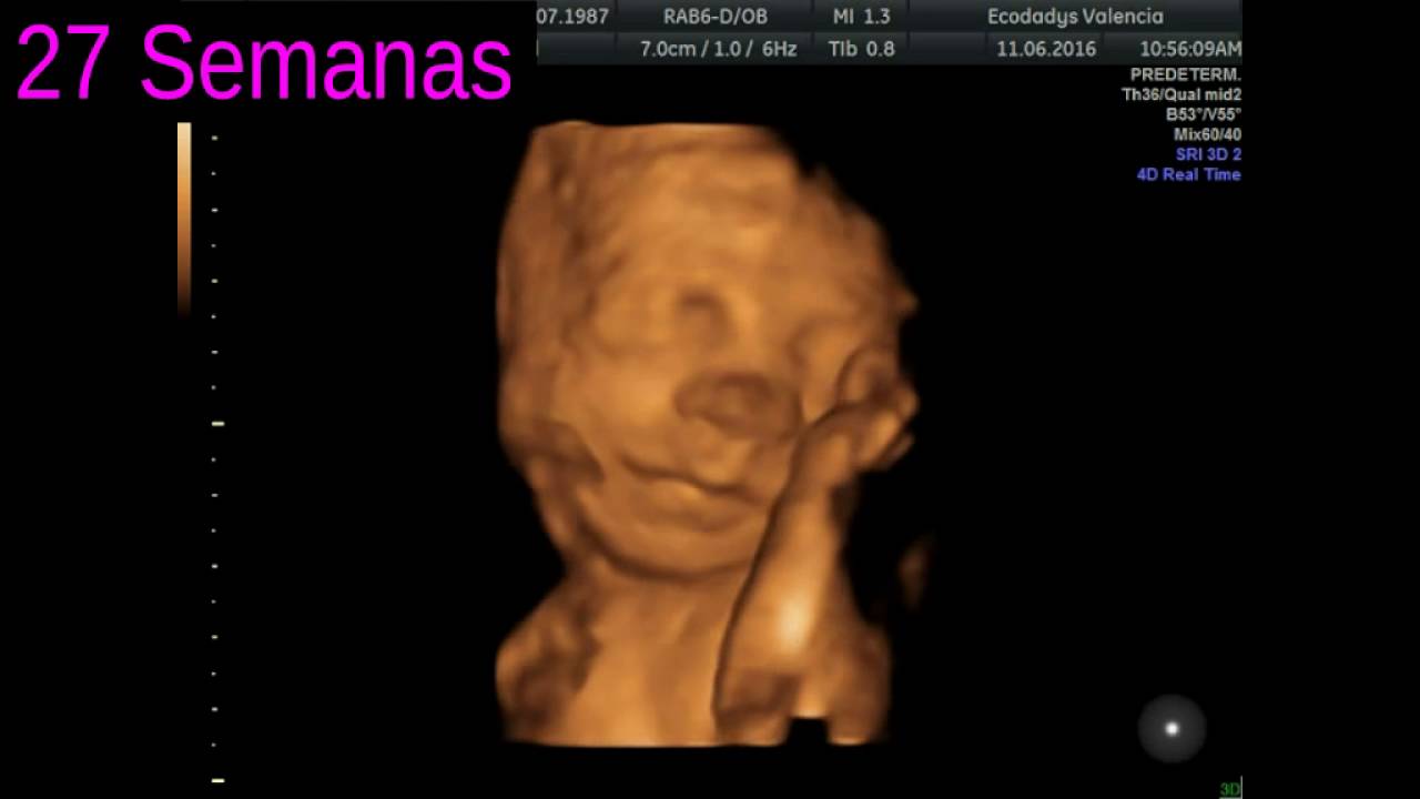 Tu Bebe Antes Y Despues De La Ecografia 4d Ecodadys