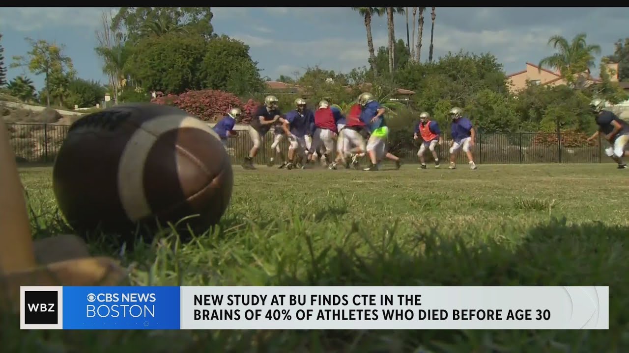 New BU study finds evidence of CTE in 41% of athletes who died young