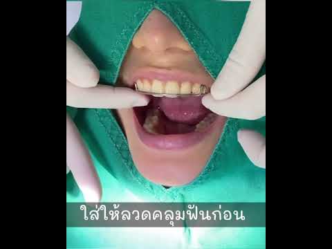 How to wear retainer l วิธีใส่รีเทนเนอร์ท่อสี l หมอตาล คุยจัดฟัน