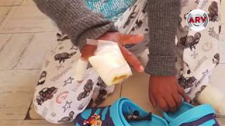 QUEMAN LAS MANOS DE UN NIÑO