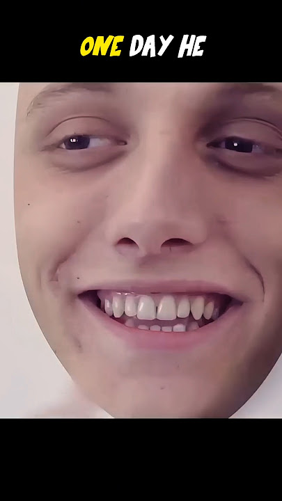 The Boy With No Face#shorts