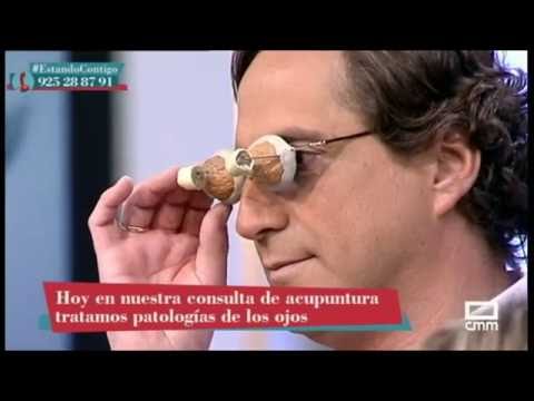 La acupuntura al servicio de la miopia y astigmatismo