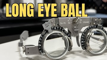 Why Myopia Is Becoming So Common