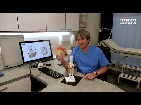 Videó: Mire Számíthat A Térdpótló Műtét Után