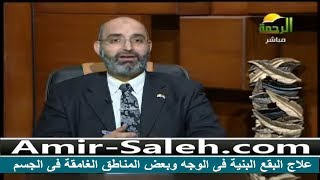 علاج البقع البنية فى الوجه وبعض المناطق الغامقة فى الجسم | الدكتور أمير صالح