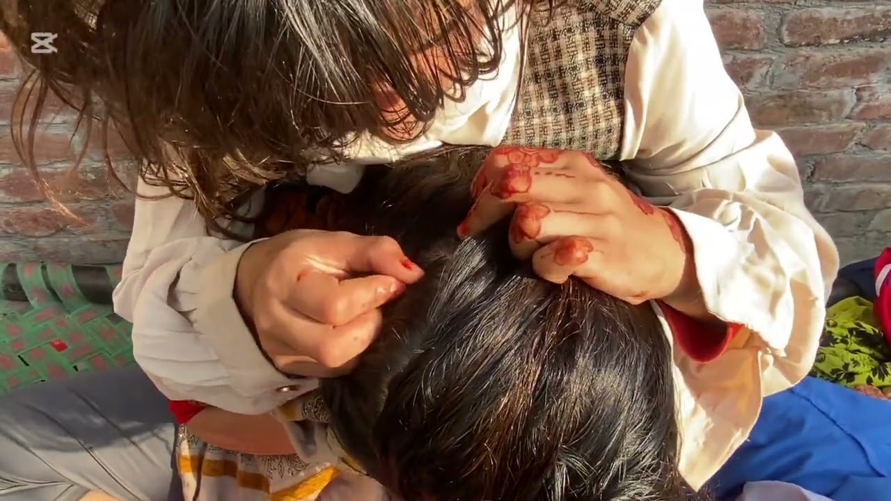 | @LaibaButt-b8t | Nits piking by Tubsum andMehvish | lots of nits | |#haircareroutine | |#longvideo