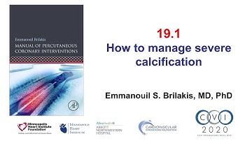19.1 Manual of PCI - Calcification