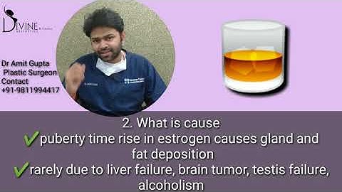 A to Z of Gynecomastia Surgery by Dr. Amit Gupta