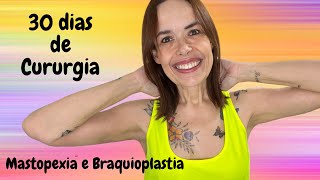 Update das cirurgias reparadoras após 30 dias (MASTOPEXIA COM PRÓTESE e BRAQUIOPLASTIA)