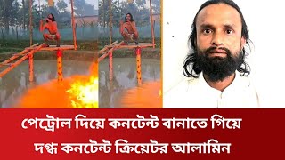 Download Lagu পেট্রোল দিয়ে কনটেন্ট বানাতে গিয়ে দ*গ্ধ কনটেন্ট ক্রিয়েটর আলামিন। Alamin MP3