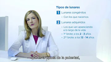 ¿A qué edad se tienen más lunares?