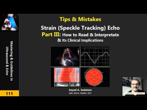 Tips & Mistakes: Strain (Speckle Tracking) Echo Part III: How to Read & 