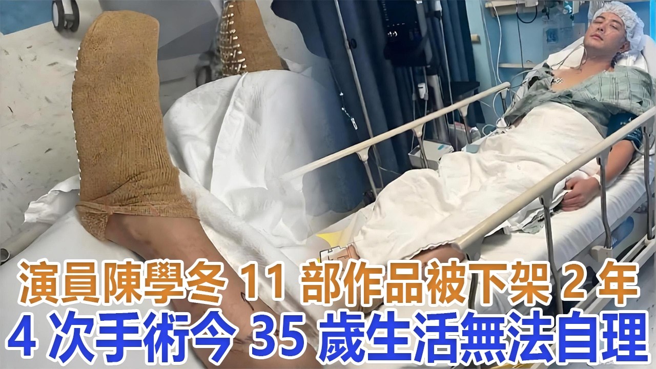 演員陳學冬：11部作品被下架，2年4次手術，今35歲生活無法自理#陳學冬