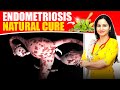 All You Need To Know About Endometriosis | Home Remedy for Endometriosis | Endometriosis Treatment