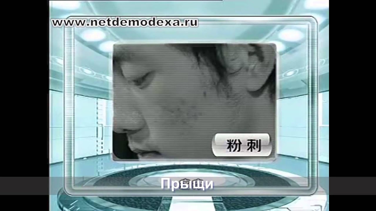 Демодекс лечение - YouTube