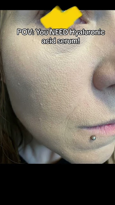 Do you NEED Hyaluronic Acid serum?! #skincare #skincareroutine