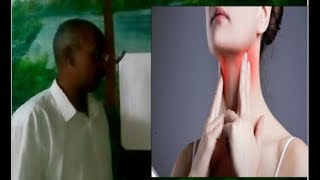 علاج الغدة الدرقية بإستخام لسع النحل  (Treatment of thyroid gland by using bee sting)