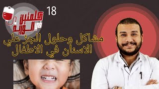 مشاكل الجز علي الاسنان في الاطفال /أسبابها،  الوقايه منها ، علاجها؟!