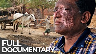 Extreme India: Cow Vigilantes, Disabled Dating &amp; More | Unreported World | Free Documentary