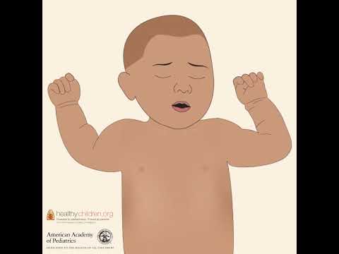 RSV: Signs & Symptoms in Babies | AAP #shorts
