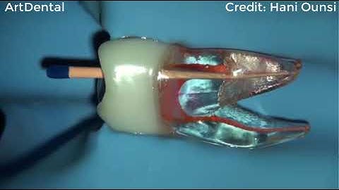 🔥🔥 Rotary Endodontics - Cleaning and Shaping🤩🤩 (By Hani Ounsi)
