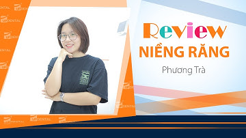 [Review niềng răng]: #160 Kết quả niềng răng của Phương Trà