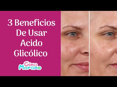 3 Beneficios De Usar Acido Glicólico