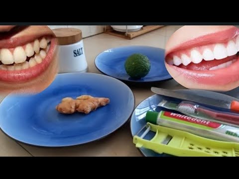 KUWA NA MENO MEUPE NI RAHISI SANA TUMIA NJIA HII