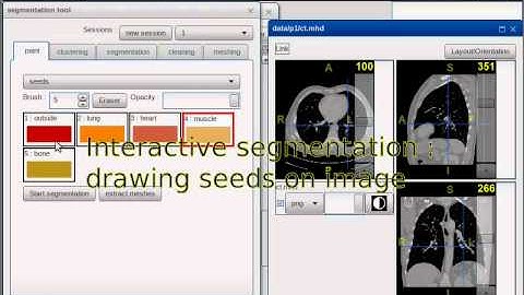 A Web Interface for 3D Visualization and Interactive Segmentation of Medical Images