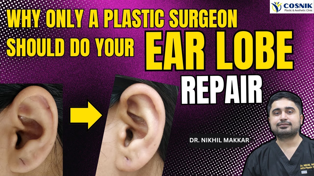 Why Only a Plastic Surgeon Should Do Your Ear Lobe Repair | Safe & Scarless Lobuloplasty Explained